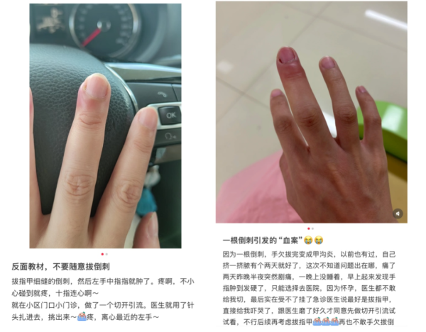 第二证券 不要拔！不要拔！有人因此进急诊、拔甲、截肢！